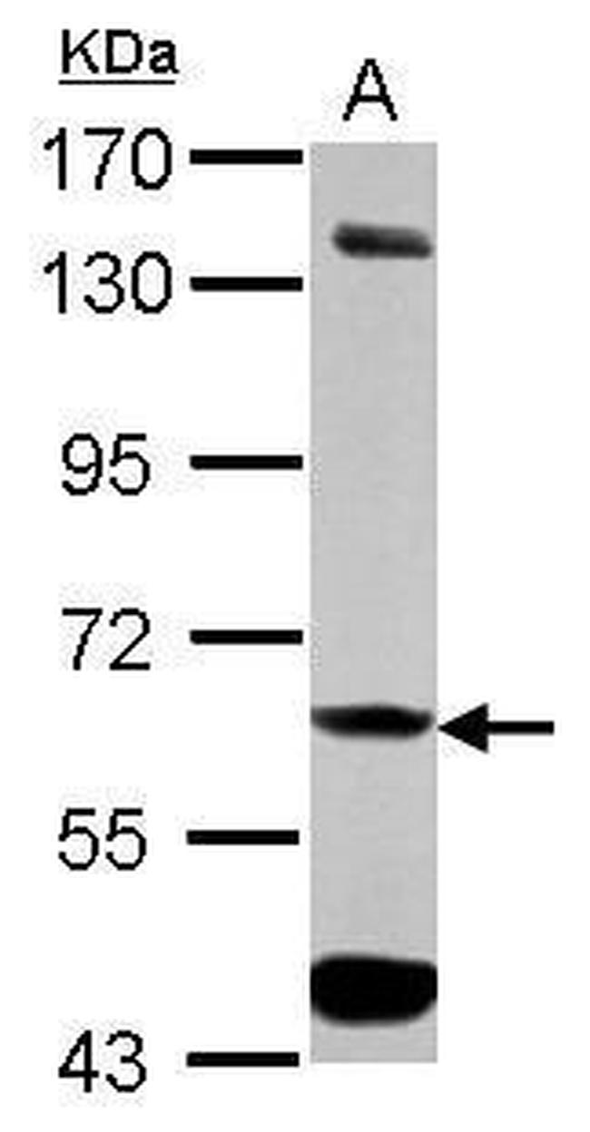 ALDH7A1 Antibody in Western Blot (WB)