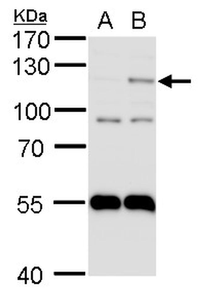 HIF-2 alpha Antibody in Western Blot (WB)