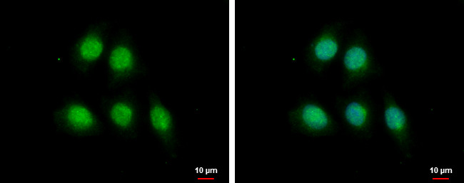 MAGE1 Antibody in Immunocytochemistry (ICC/IF)