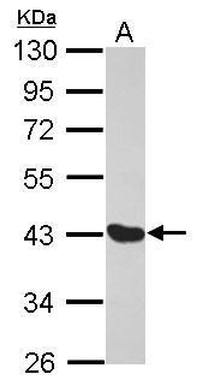 MAGE1 Antibody in Western Blot (WB)