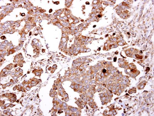 GLB1 Antibody in Immunohistochemistry (Paraffin) (IHC (P))