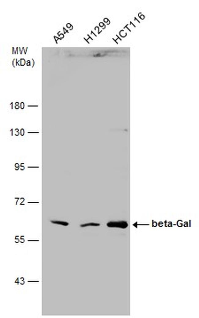 GLB1 Antibody in Western Blot (WB)