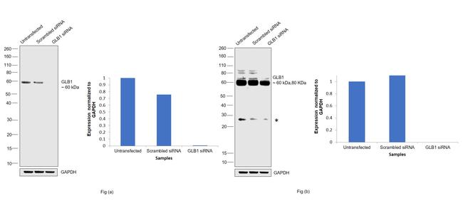 GLB1 Antibody in Western Blot (WB)