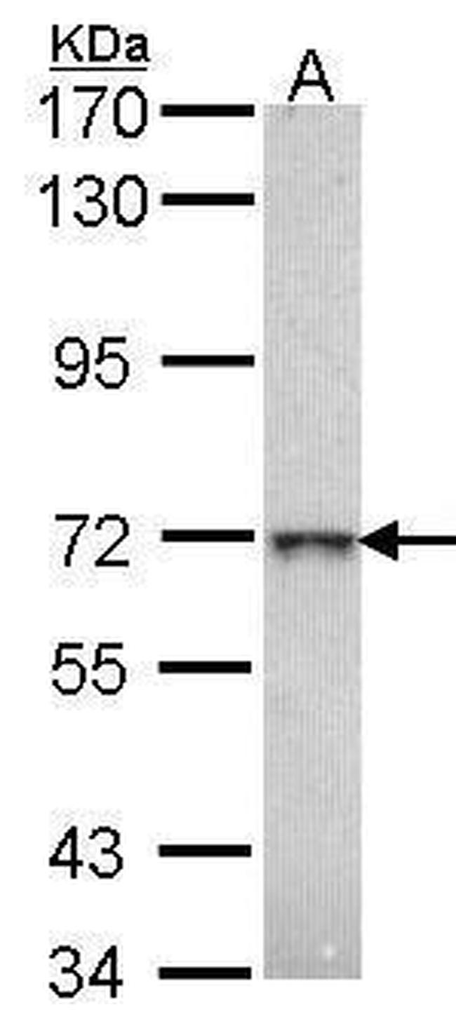 GLB1 Antibody in Western Blot (WB)