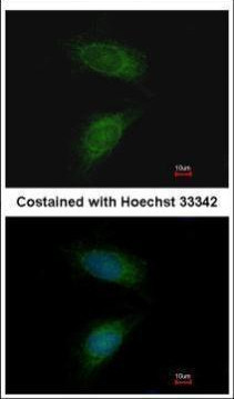 MMP2 Antibody in Immunocytochemistry (ICC/IF)