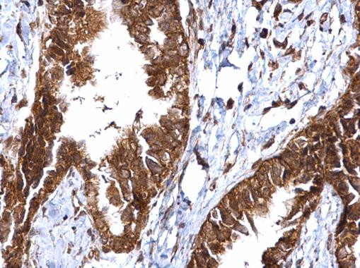 MMP2 Antibody in Immunohistochemistry (Paraffin) (IHC (P))