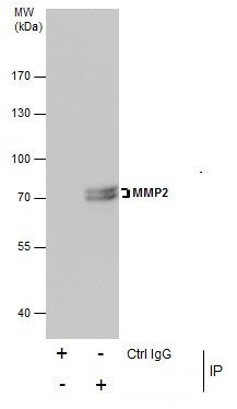 MMP2 Antibody in Immunoprecipitation (IP)