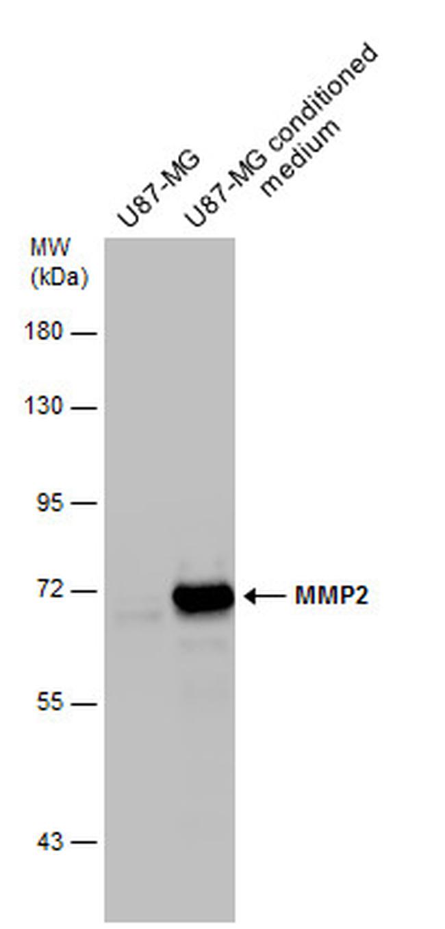 MMP2 Antibody in Western Blot (WB)