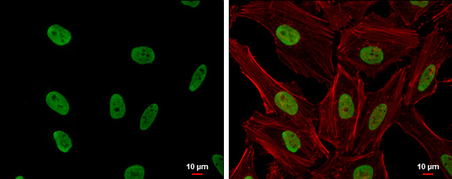 CSB Antibody in Immunocytochemistry (ICC/IF)