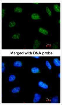 STAT3 Antibody in Immunocytochemistry (ICC/IF)