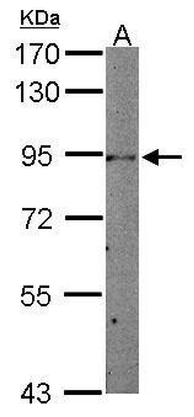 STAT3 Antibody in Western Blot (WB)