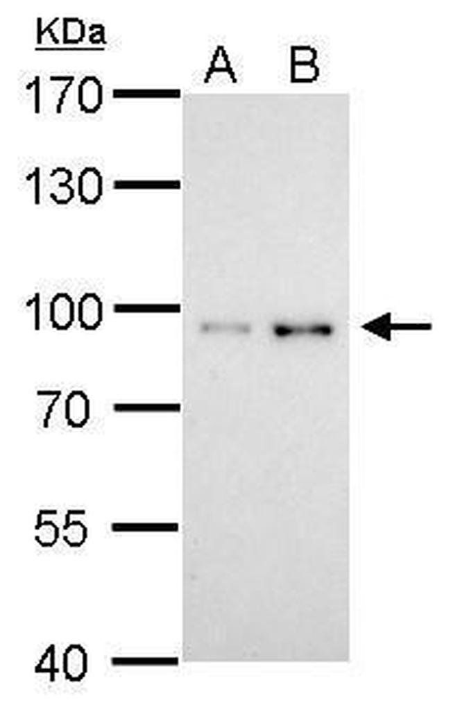 STAT3 Antibody in Western Blot (WB)