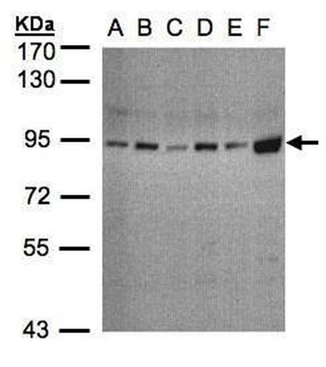 STAT3 Antibody in Western Blot (WB)