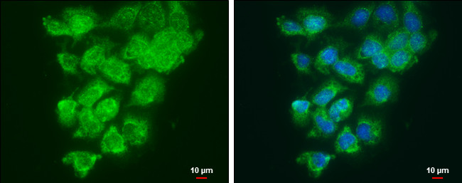 LOXL2 Antibody in Immunocytochemistry (ICC/IF)