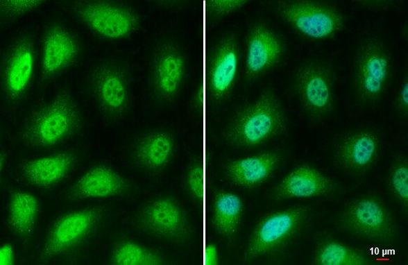 LOXL2 Antibody in Immunocytochemistry (ICC/IF)