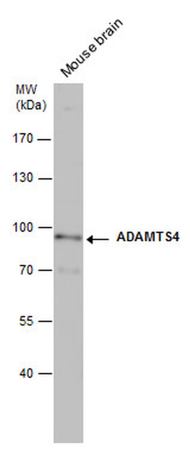 ADAMTS4 Antibody in Western Blot (WB)