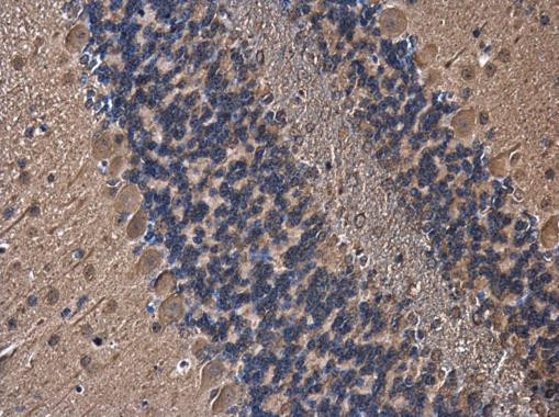 PLCL1 Antibody in Immunohistochemistry (Paraffin) (IHC (P))