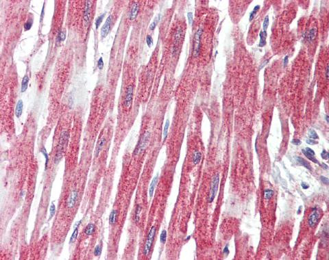 PLCL1 Antibody in Immunohistochemistry (Paraffin) (IHC (P))