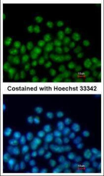 Nkx2.5 Antibody in Immunocytochemistry (ICC/IF)