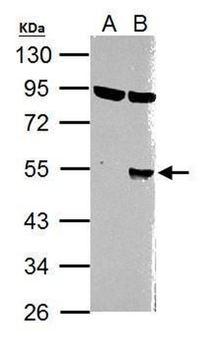 WNT1 Antibody in Western Blot (WB)