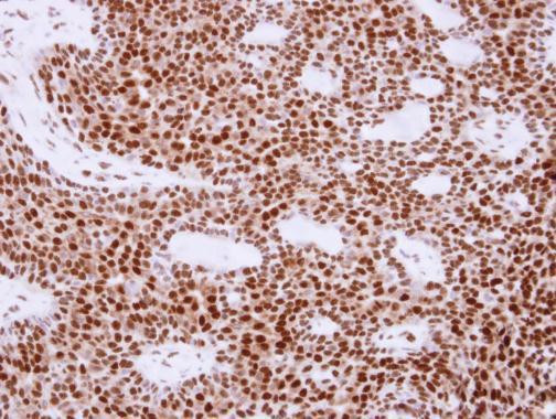 APE1 Antibody in Immunohistochemistry (Paraffin) (IHC (P))