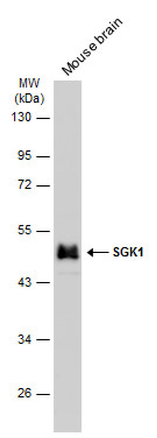 SGK1 Antibody in Western Blot (WB)