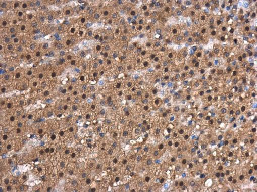 CDK9 Antibody in Immunohistochemistry (Paraffin) (IHC (P))