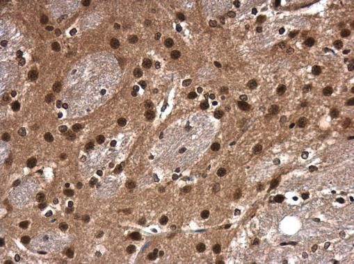 CDK9 Antibody in Immunohistochemistry (Paraffin) (IHC (P))