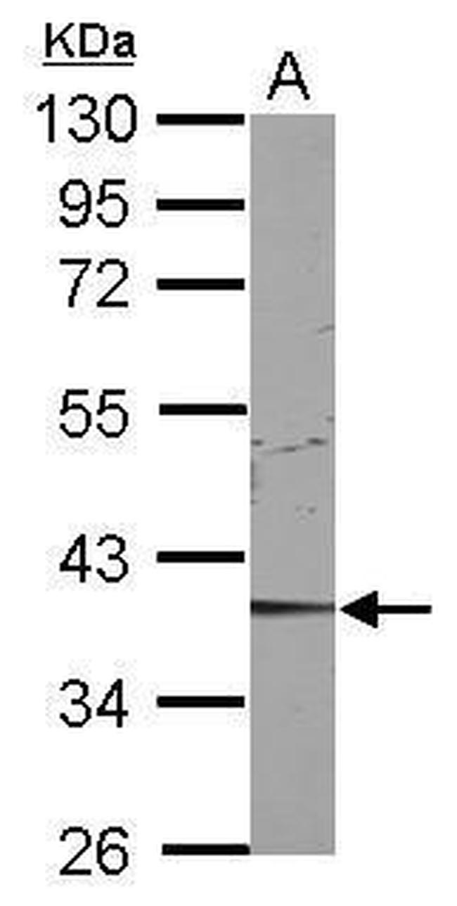 CDK9 Antibody in Western Blot (WB)