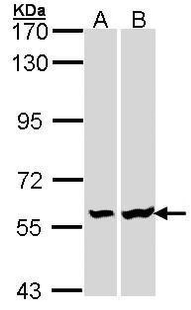 LCK Antibody in Western Blot (WB)