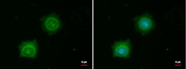 PINK1 Antibody in Immunocytochemistry (ICC/IF)