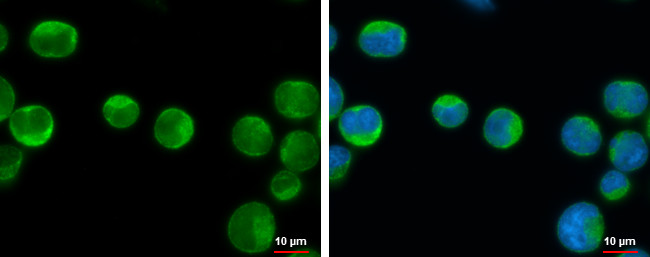 IKK beta Antibody in Immunocytochemistry (ICC/IF)