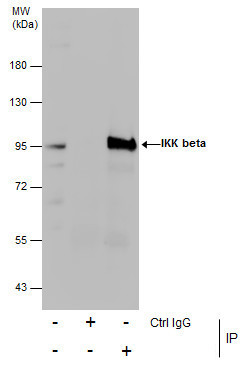 IKK beta Antibody in Immunoprecipitation (IP)