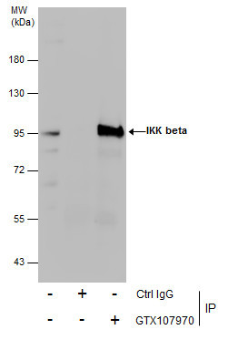 IKK beta Antibody in Immunoprecipitation (IP)