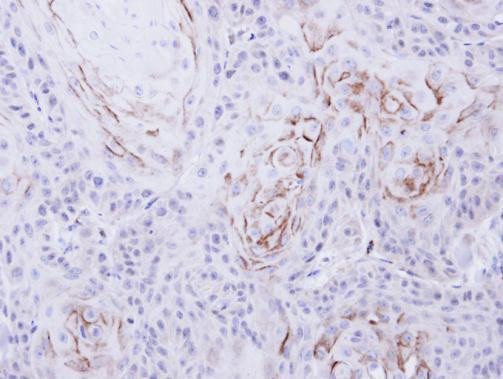 OPRM1 Antibody in Immunohistochemistry (Paraffin) (IHC (P))