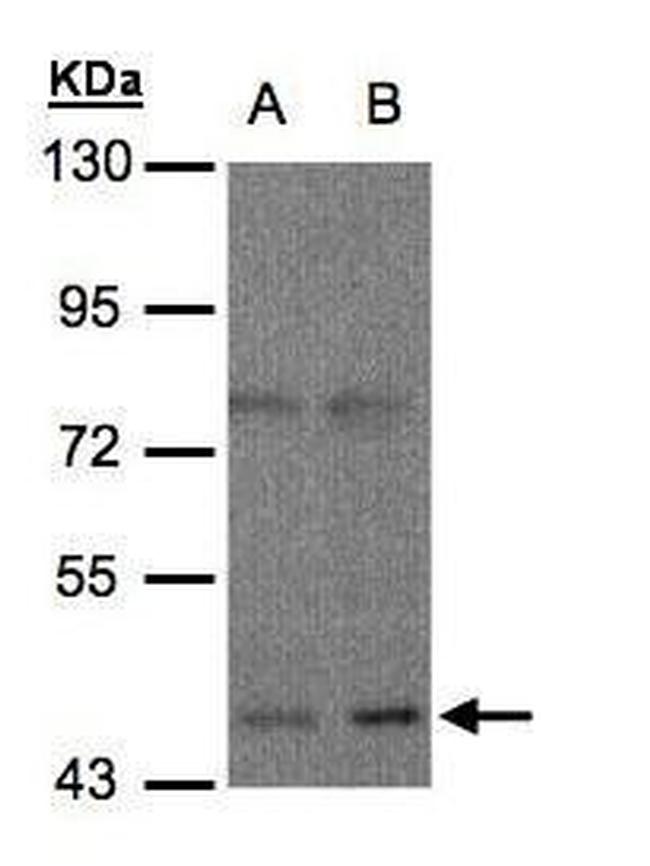 OPRM1 Antibody in Western Blot (WB)