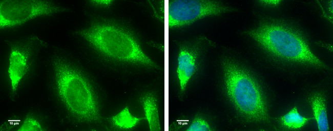 TBK1 Antibody in Immunocytochemistry (ICC/IF)