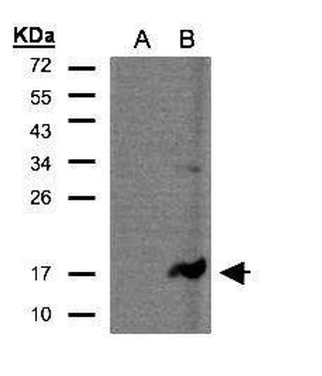 CD3z Antibody in Western Blot (WB)