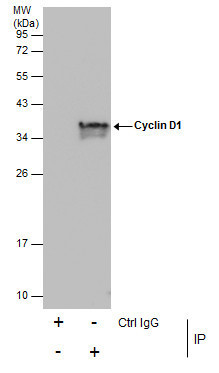 Cyclin D1 Antibody in Immunoprecipitation (IP)