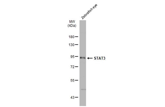 STAT3 Antibody in Western Blot (WB)