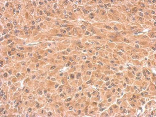 DCTD Antibody in Immunohistochemistry (Paraffin) (IHC (P))