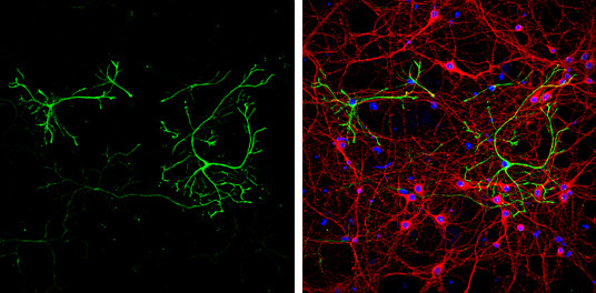 GFAP Antibody in Immunocytochemistry (ICC/IF)