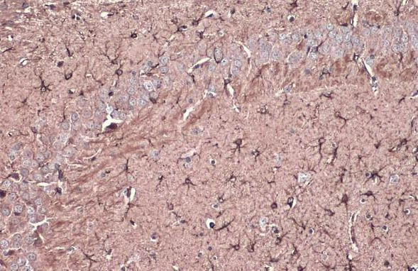 GFAP Antibody in Immunohistochemistry (Paraffin) (IHC (P))