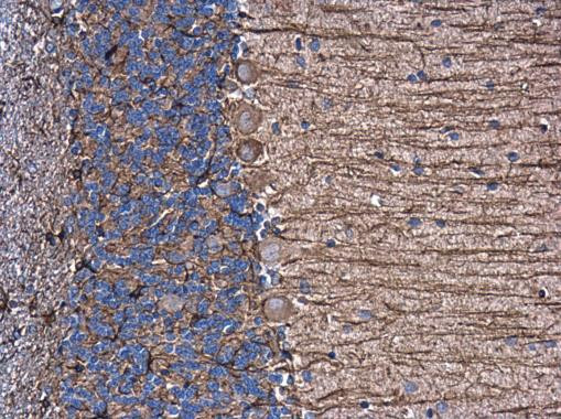 GFAP Antibody in Immunohistochemistry (Paraffin) (IHC (P))