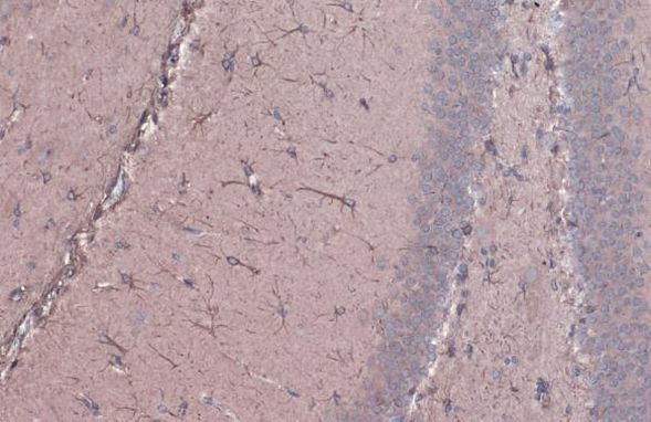 GFAP Antibody in Immunohistochemistry (Paraffin) (IHC (P))