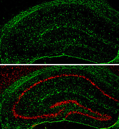 GFAP Antibody in Immunohistochemistry (Frozen) (IHC (F))