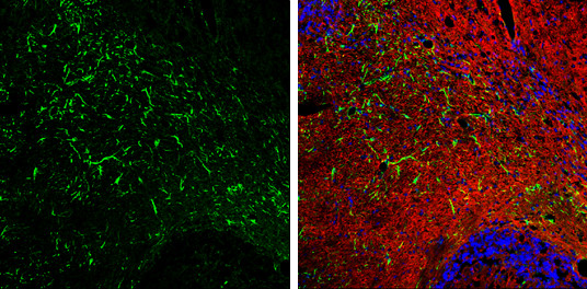 GFAP Antibody in Immunohistochemistry (Frozen) (IHC (F))