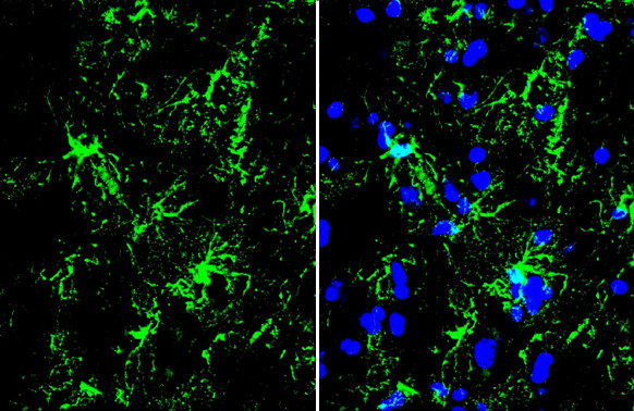 GFAP Antibody in Immunohistochemistry (Frozen) (IHC (F))