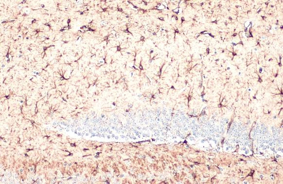 GFAP Antibody in Immunohistochemistry (Paraffin) (IHC (P))