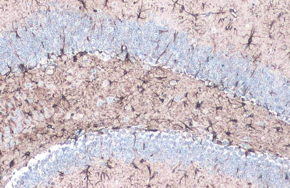 GFAP Antibody in Immunohistochemistry (Paraffin) (IHC (P))